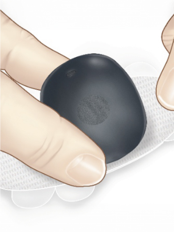 Fingers pinch the small Eversense CGM transmitter 